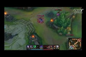 文森特附体！ 2 vs 5德莱文精彩反杀